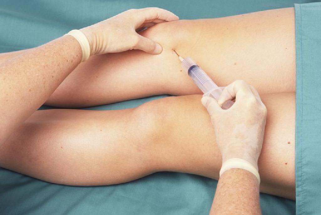 Pripreme za injekcije u zglobu koljena s artrozom