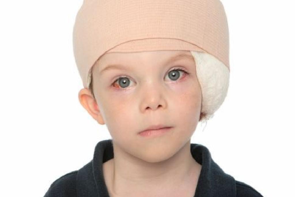 Memulihkan Selepas Pembedahan Berapa Lama Mendapatkan Pemulihan