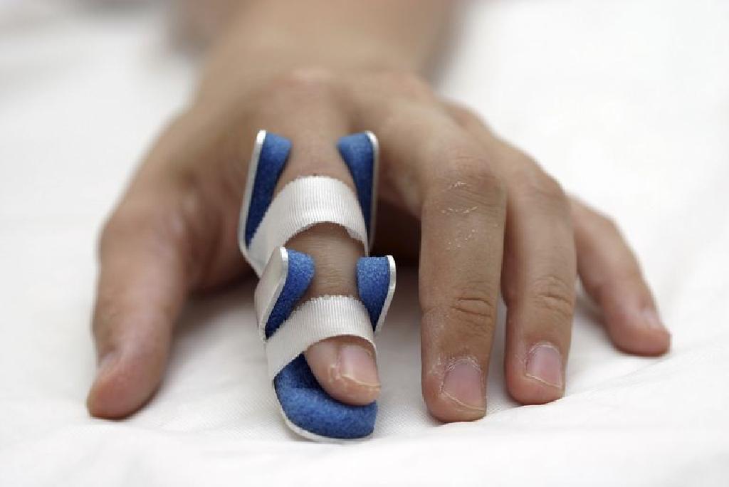 tratamentul fracturii articulației degetelor