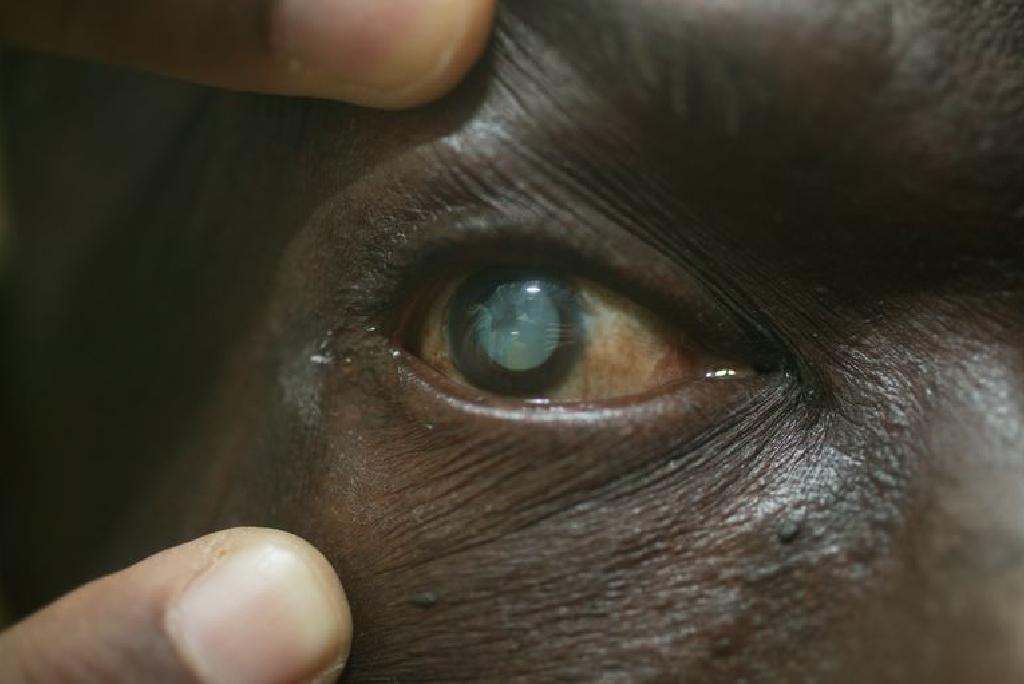 Test de iritare oculară