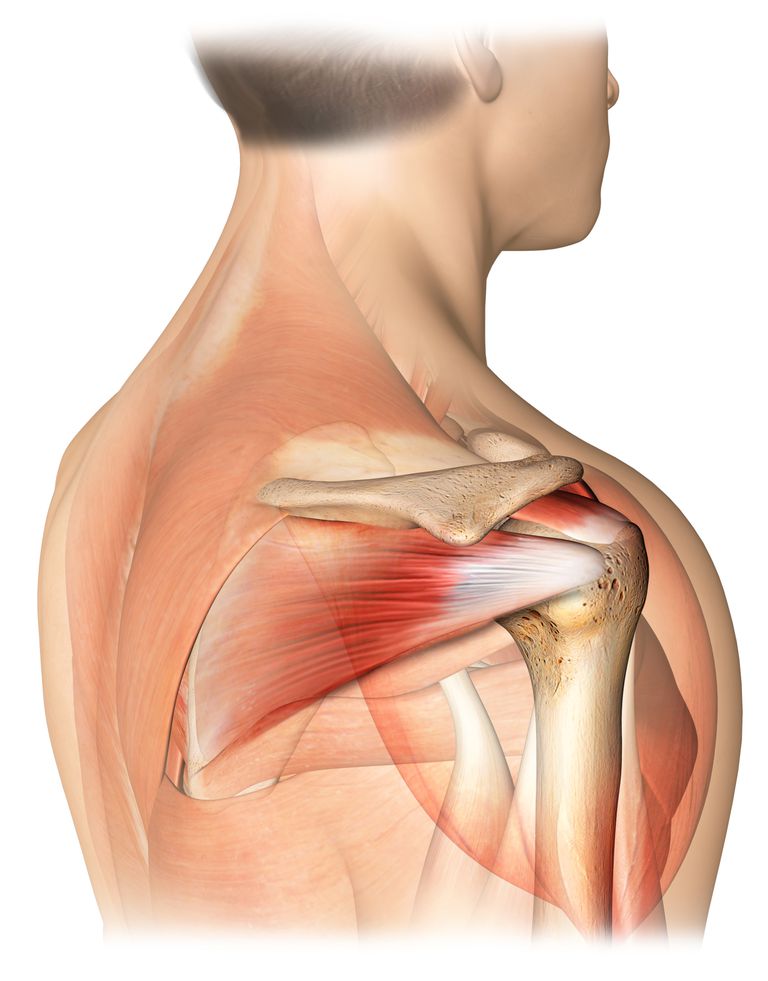 Deteriorarea tendoanelor manșetei de rotație a articulației umărului. Cauzele tendinitei