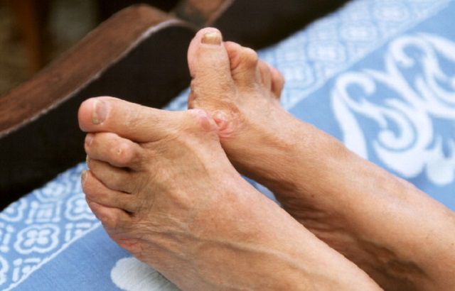 kako ublažiti bol u zglobu lakta zglob koljena i bol stopala