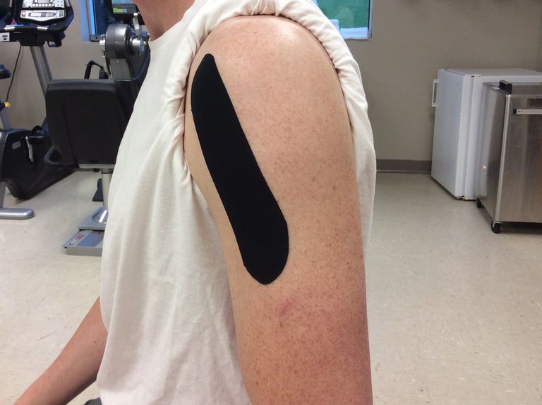 kako se nositi s bolovima u ramenima diprospan pregledi za bol u ramenom zglobu
