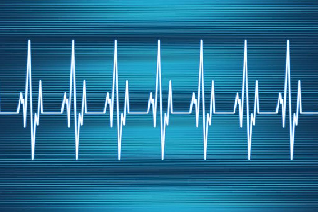 نظرة عامة على Tachycardias وإيقاعات القلب السريع