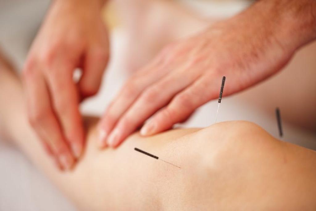 liječenje artritisa akupunktura)