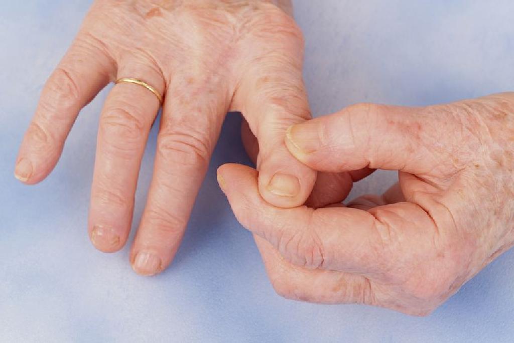 Artritisa zglobova prstiju
