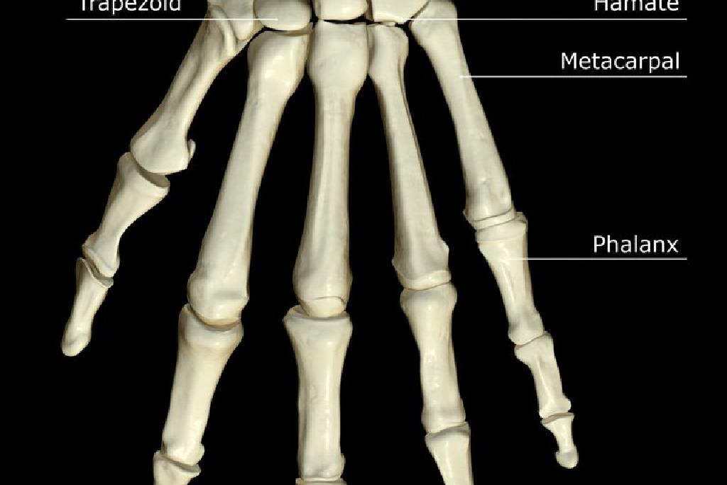 手腕骨中hamate Bone钩骨骨折