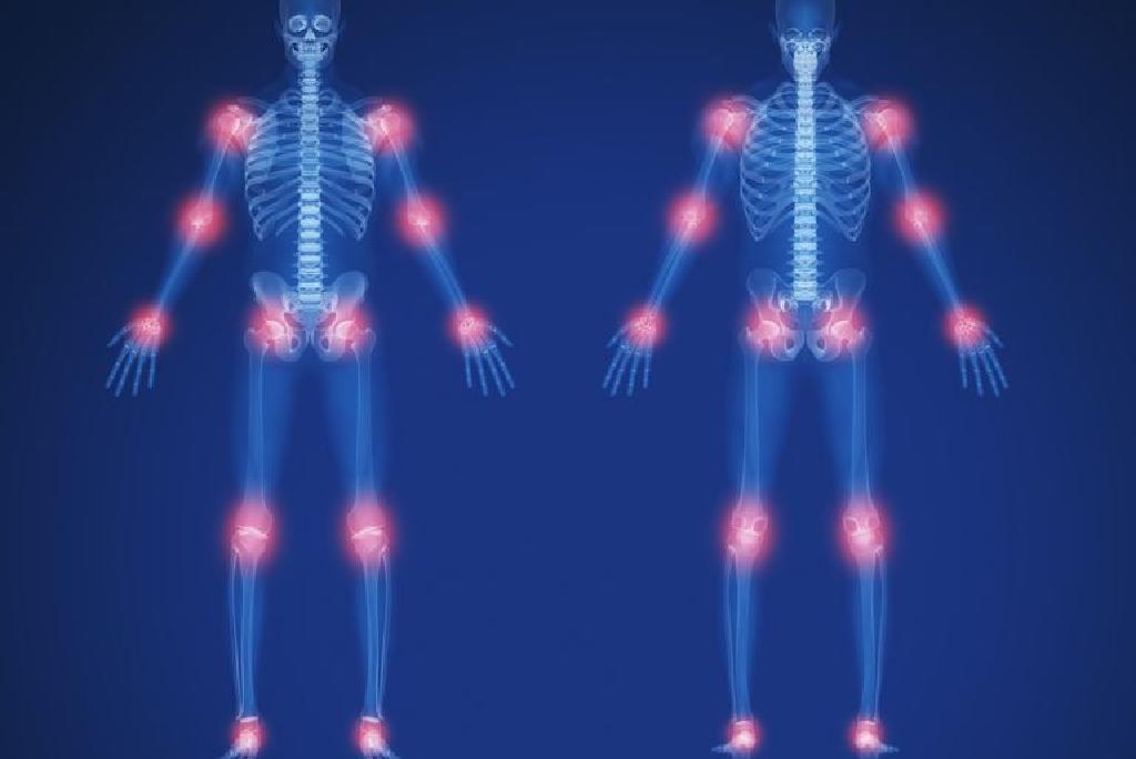 Bole vas kosti i zglobovi? Liječnik savjetuje kako najbolje brinuti o koštanom tkivu
