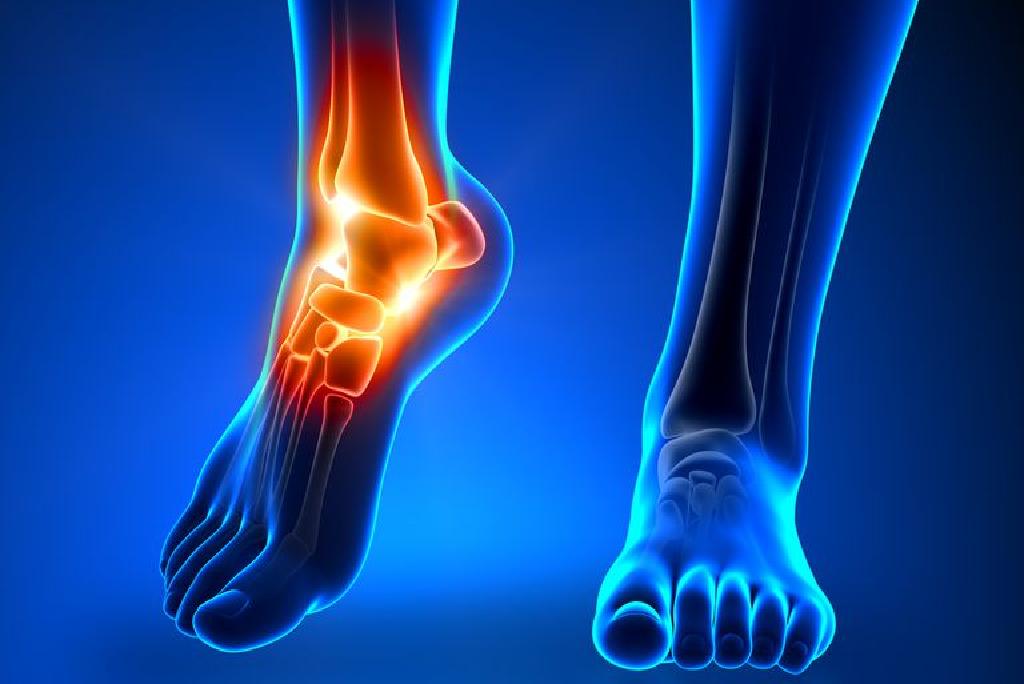 lijekovi protiv bolova u zglobovima nogu injekcije liječenje osteoartritisa 1 tbsp.